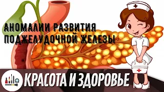 Аномалии развития поджелудочной железы