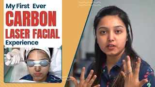 My first ever carbon laser facial experience | Carbon laser facial for isntant glow  in Delhi