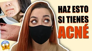 ✅ 8 TIPS para ELIMINAR ACNÉ por MASCARILLA ➡️[FUNCIONA!]