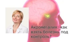 Акромегалия: как взять болезнь под контроль?