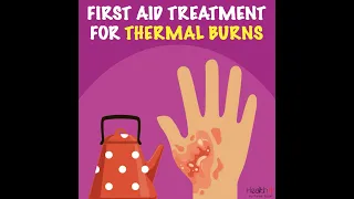 First Aid Treatment for Thermal Burns