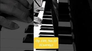 Study No.31 (100 Progressive Studies, Op.139) by Czerny