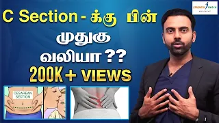 (Caesarean) C section vs Back Pain, pregnancy பிரசவமும் முதுகு வலிக்கான தொடர்பும் | Dr Ashwin Vijay