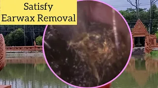 Satisfying Ear Wax Removal Compilation