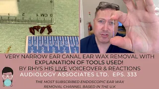 VERY NARROW EAR CANAL EAR WAX REMOVAL WITH EXPLANATION OF TOOLS USED - EP 333