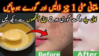 Multani mitti face pack for glowing skin | instant whitening cream by hadiya cooking and tips