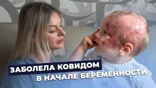 ГИГАНТСКИЙ НЕВУС | История Димы Чабанюка