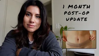 My Tummy Tuck Journey: 1 Month Post-Op Update