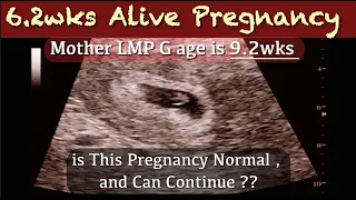 6+ wks Early Pregnancy Ultrasound - Mother LMP G Age is 9+wks | is this Normal ??