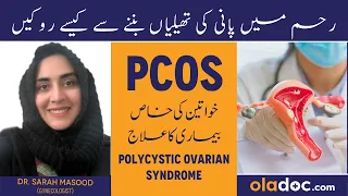 What is PCOS Kya Hai In Urdu/Hindi - PCOS Treatment - How to Treat PCOS ka Ilaj - PCOS Symptoms