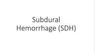 Subdural Hemorrhage (SDH) - General Surgery