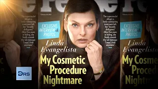 What Happened with Linda Evangelista and the Fat Freezing Procedure?