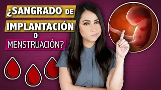 Implantation Bleeding vs Period | How to tell the difference 👩🏻‍⚕️ Dra. Pau Zúñiga