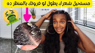 😱🤮💔 اتخلصي من دهون وقشور الفروه بالديتوكس والتقشير الشهري لفروة الشعر | Scalp DETOX & EXFOLIATION