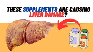 Supplements that can DAMAGE your Liver (Avoid overuse!)