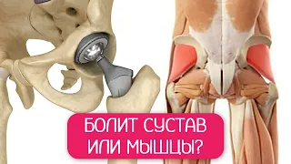 Всегда ли нужно эндопротезирование суставов?