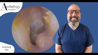 SWIMMERS/SURFERS EAR WAX REMOVAL - EP749