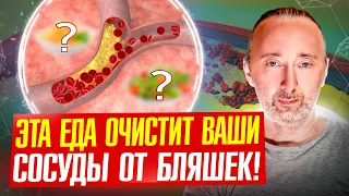 Как очистить сосуды от атеросклеротических бляшек, кальция, тромбов?