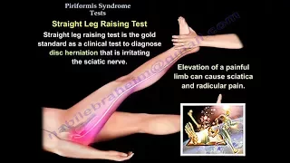 Piriformis Test - Everything You Need To Know - Dr. Nabil Ebraheim