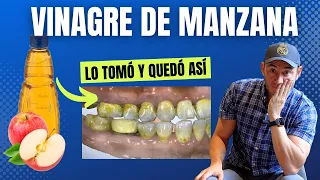 Así quedó después de tomar Vinagre de Manzana por un año