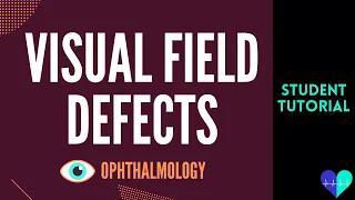 Visual Field Defects - Medical Tutorial