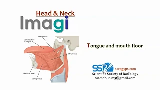 8 Tongue and mouth floor Imaging - prof.Mamdouh Mahfouz (2019 edition)