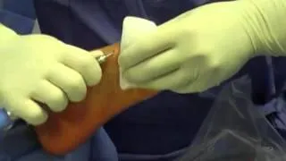 chirurgia miniinvasiva del piede