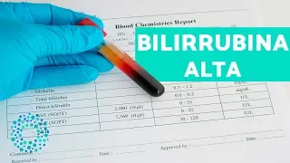 Bilirrubina ALTA: Sintomas e TRATAMENTOS NATURAIS