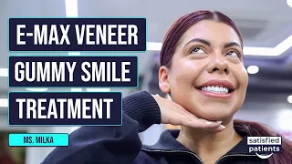 Milka's Dream Smile Comes True With Veneers And Lip Repositioning In Istanbul