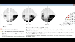 2. AUTOMATED VISUAL FIELD INTERPRETATION