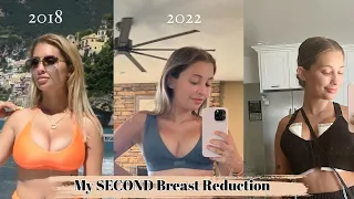 My SECOND Breast Reduction: surgery + healing updates