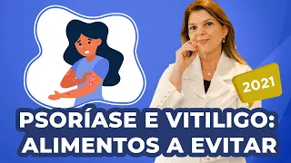 Psoríase e vitiligo   Alimentos a evitar