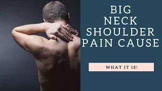 Tightness In This Muscle Causes GREAT Neck Pain and Shoulder Pain | How To Stretch It!