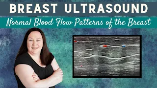Breast Ultrasound - Normal Blood Flow Patterns of the Breast - Sonography Minutes