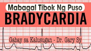 Bradycardia (Slow Heart Rate) - Dr. Gary Sy