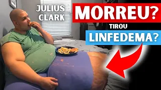 QUILOS MORTAIS | JULIUS CLARK "JT" O QUE ACONTECEU? TIROU O LINFEDEMA? O QUE SE SABE DELE?