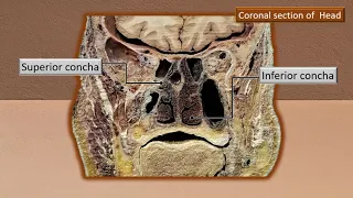 Lateral wall of nose