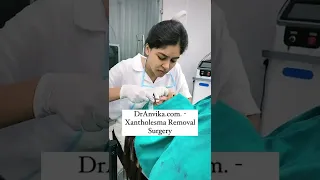 Xantholesma surgery treatment | Surgery Video | Skin Treatment Video | Dr Anvika #shorts