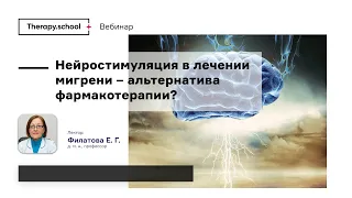 Нейростимуляция в лечении мигрени-  альтернатива фармакотерапии