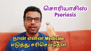 Psoriasis medicine | My psoriasis story | Psoriasis treatment in tamil | psoriasis | சொரியாசிஸ்