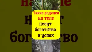 Какие родинки на теле несут богатство и успех