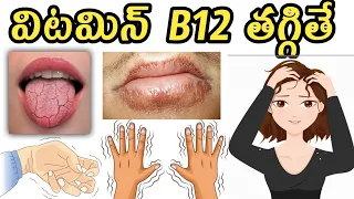 Low Vitamin B12 Symptoms in Telugu(విటమిన్ బి 12 )