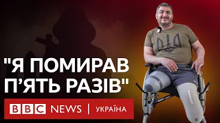 "Мотнися, купи мені ноги і я пішов": історія військового на протезах