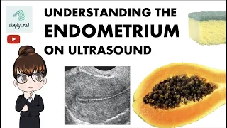 Understanding the Endometrium on Ultrasound