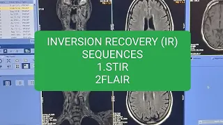 MRI Inversion Recovery sequences Stir and Flair ko kese phchane @Mri stir sequences or flair seq