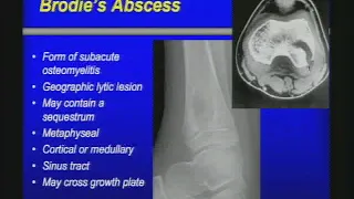 MSK Infections disease, cases