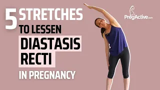Pregnancy Stretches for Diastasis Relief