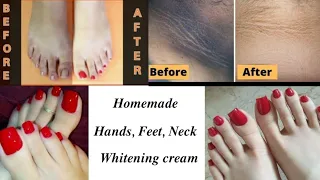 Hand, Feet and Neck whitening Cream 100% Results | How to use Clobevate Cream. Makeup by COsMiC