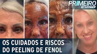 Peeling de fenol: tratamento estético profundo exige cuidados | Primeiro Impacto (08/11/22)