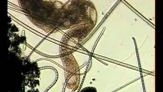 SPIROSTOMUM AMBIGUUM? CILIADO CILIATE